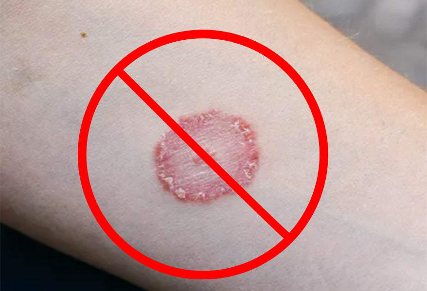 BJJ Guide: How to Prevent Skin Infections – Fighters Market